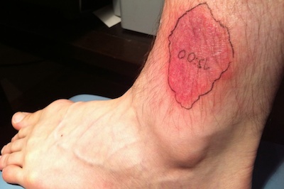 Strange Lesion